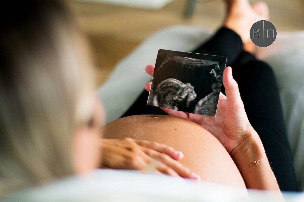 Γονιμότητα: 5 λόγοι για να δοκιμάσετε τον βελονισμό