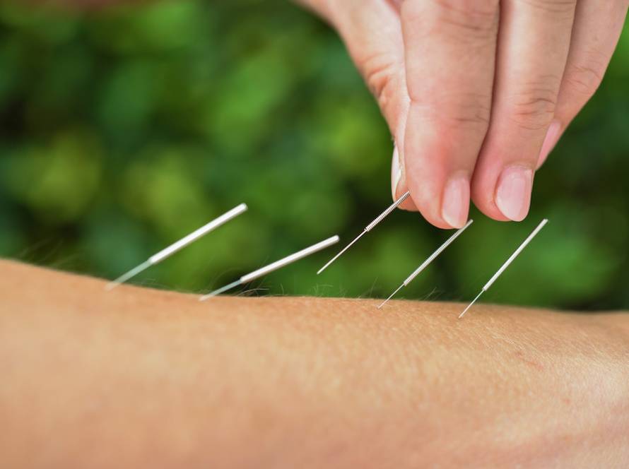 Βελονισμός: Η Επιστήμη πίσω από την Ανακούφιση του Πόνου